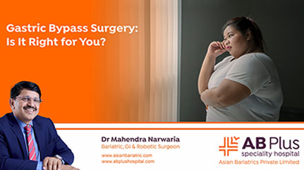 Gastric Bypass Surgery: Is It Right for You?