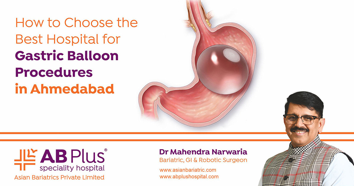 How to Choose the Best Hospital for Gastric Balloon Procedures in Ahmedabad